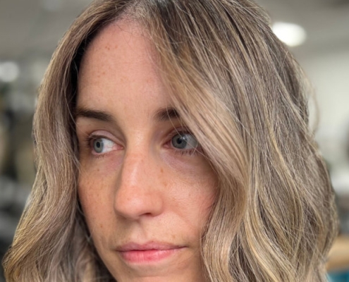 How to boost your confidence when dealing with thinning hair