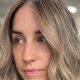 How to boost your confidence when dealing with thinning hair