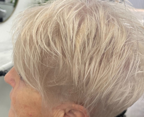 Thinning hair
